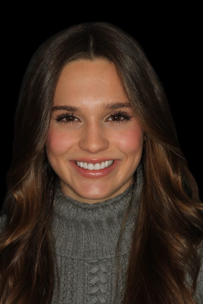 Los Angeles & Beverly Hills Top Cosmetic Dentist